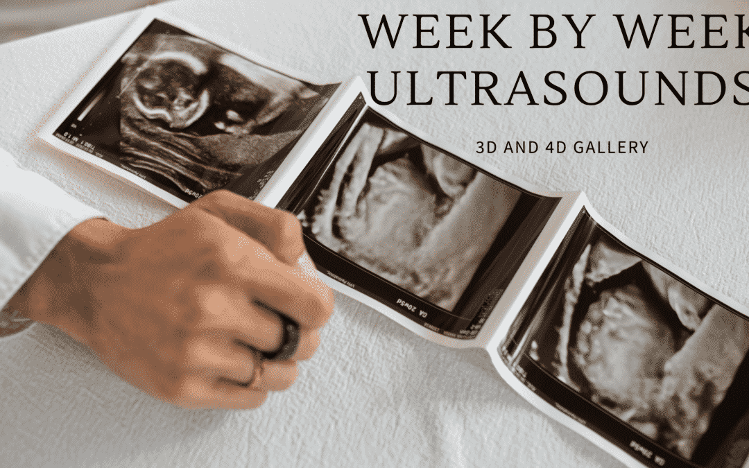 Week by Week Gallery of 3D/4D Ultrasound