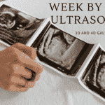 week by week 3d/4d/5d ultrasound photo gallery