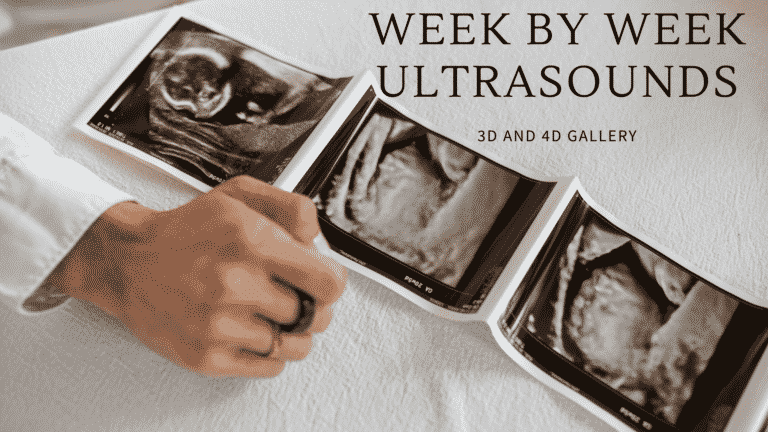 Week by Week Gallery of 3D/4D Ultrasound