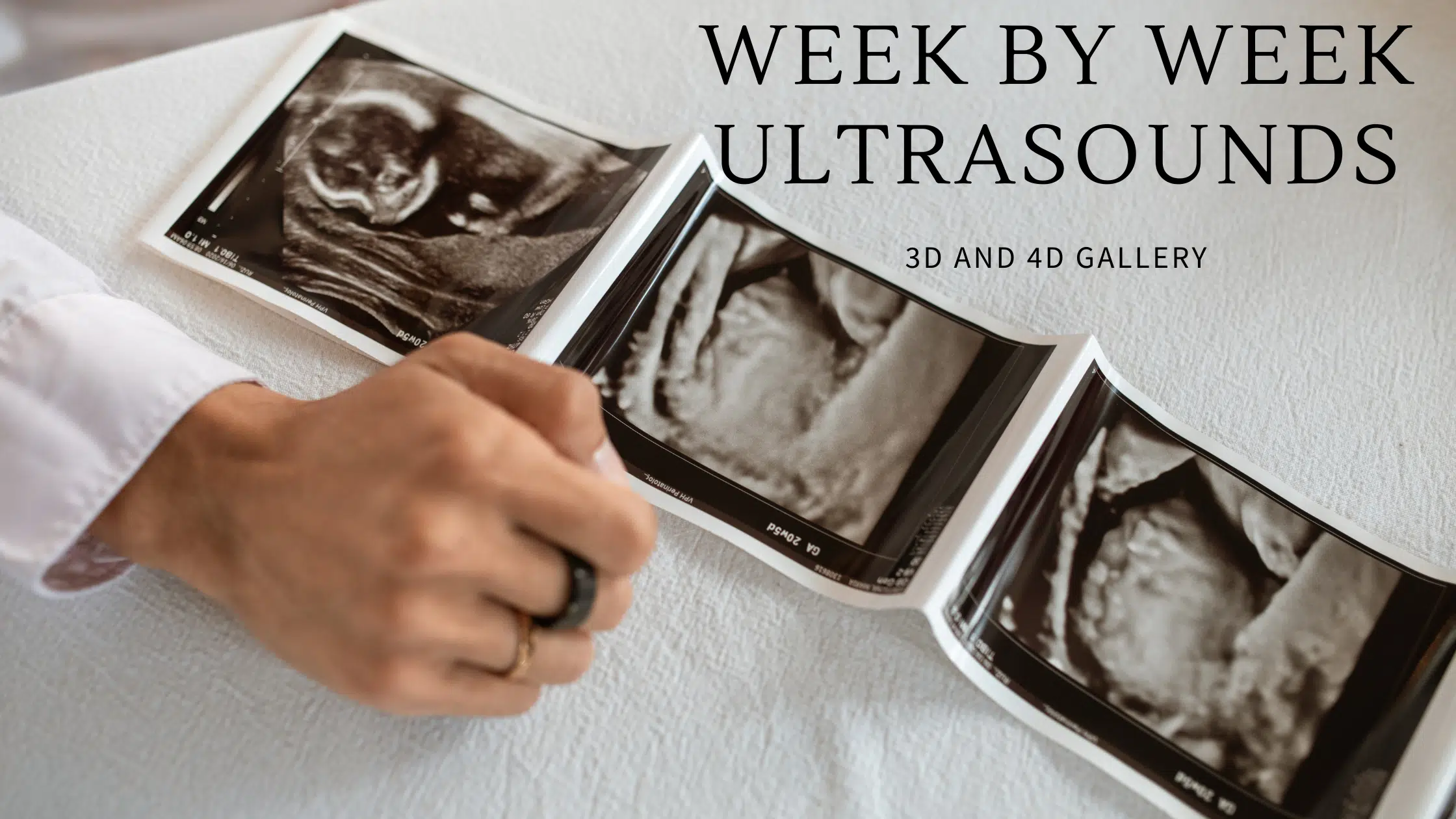 week by week 3d/4d/5d ultrasound photo gallery