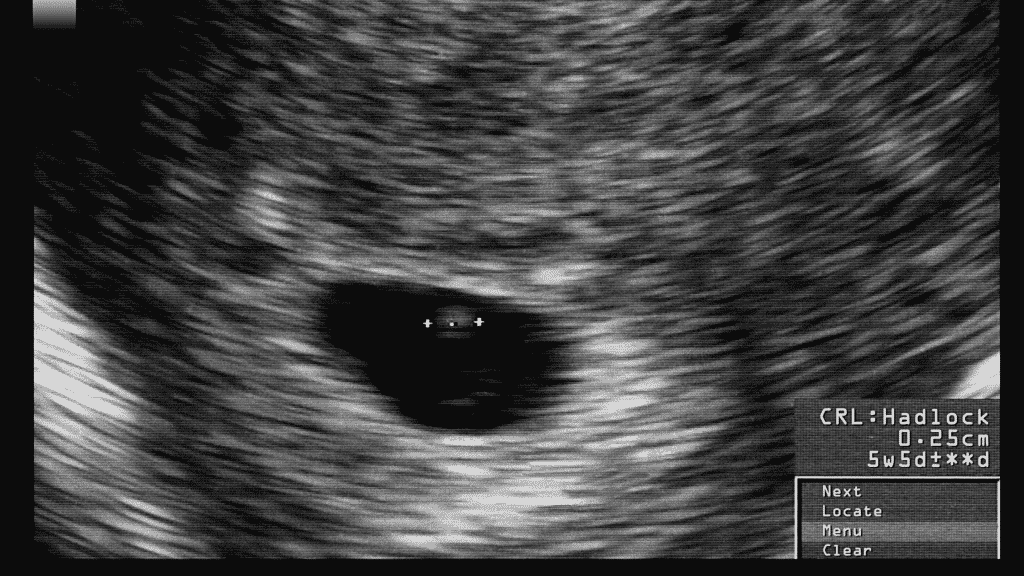 3 weeks ultrasound